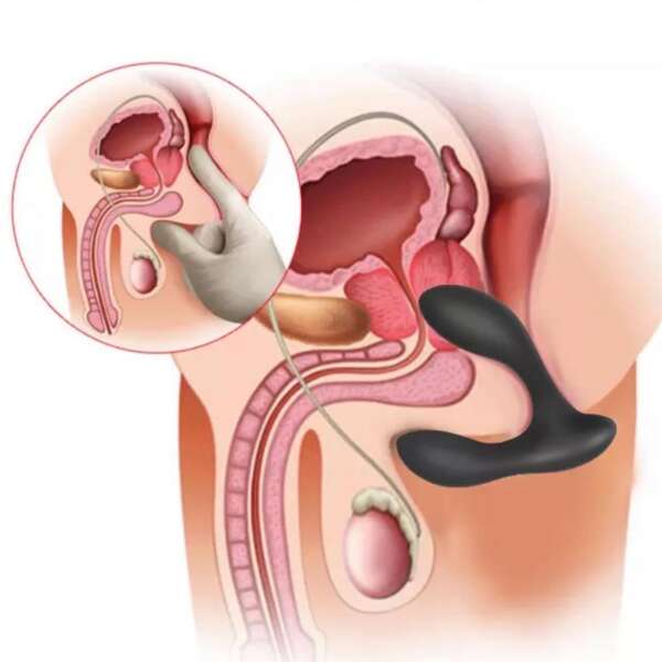 Brett Prostate Massager Remote Control USB Liquid Silicone – Image 4